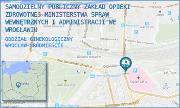 ODDZIAŁ GINEKOLOGICZNY - SAMODZIELNY PUBLICZNY ZAKŁAD OPIEKI ZDROWOTNEJ MINISTERSTWA SPRAW WEWNĘTRZNYCH I ADMINISTRACJI WE WROCŁAWIU - UL. OŁBIŃSKA 32,  WROCŁAW-ŚRÓDMIEŚCIE