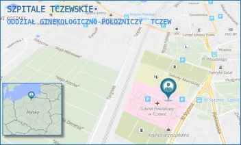 ODDZIAŁ GINEKOLOGICZNO-POŁOŻNICZY - SZPITALE TCZEWSKIE - UL. 30-GO STYCZNIA 57/58,  TCZEW