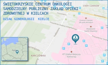 DZIAŁ GINEKOLOGII - ŚWIĘTOKRZYSKIE CENTRUM ONKOLOGII SAMODZIELNY PUBLICZNY ZAKŁAD OPIEKI ZDROWOTNEJ W KIELCACH - ARTWIŃSKIEGO 3,  KIELCE